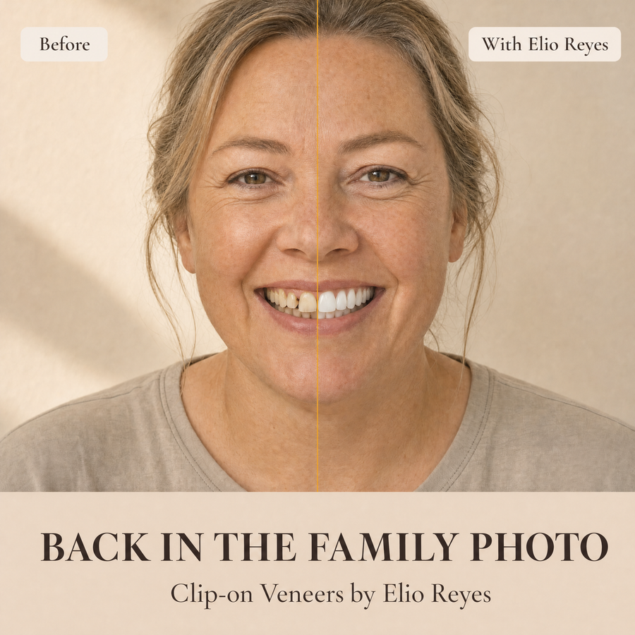 Illustration: smile before and with Elio Reyes veneers